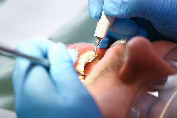 Best Urgent Care for Lost Fillings or Crowns in Wyoming, PA