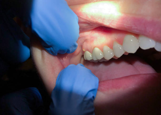 Best Emergency TMJ Treatment in Wyoming, PA